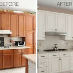 8 Amazing Refacing Transformations [Before & After Photos]